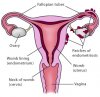 endometriosis-anatomy-final_default.jpg