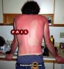 sunburnfail_zps7cbd47db.jpg