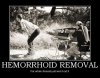 Hemorrhoid-removal.jpg