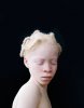 Albino.jpg