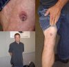 scott-nipple-knee.jpg