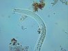 2016-12-07_nematode2b-400x (1).jpg