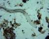 mystery-nematode200x.jpg