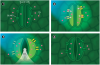 synthetic Ion channel.png