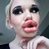 bulgariangirlbiggest-lips1.jpg