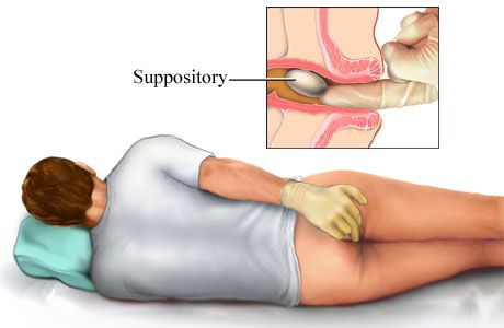 suppositories.jpg