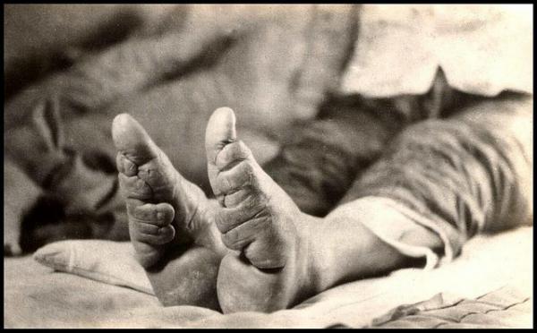 footbinding+(15).jpg