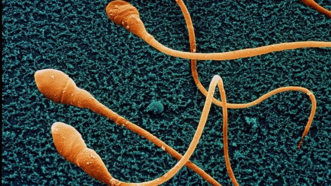 _97076563_sperm.jpg