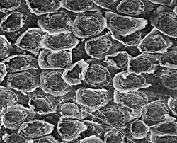 Till_flex_trichomes.jpg