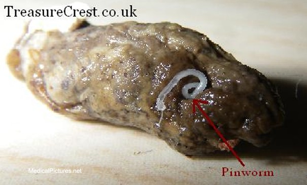 pinworms+3.jpg