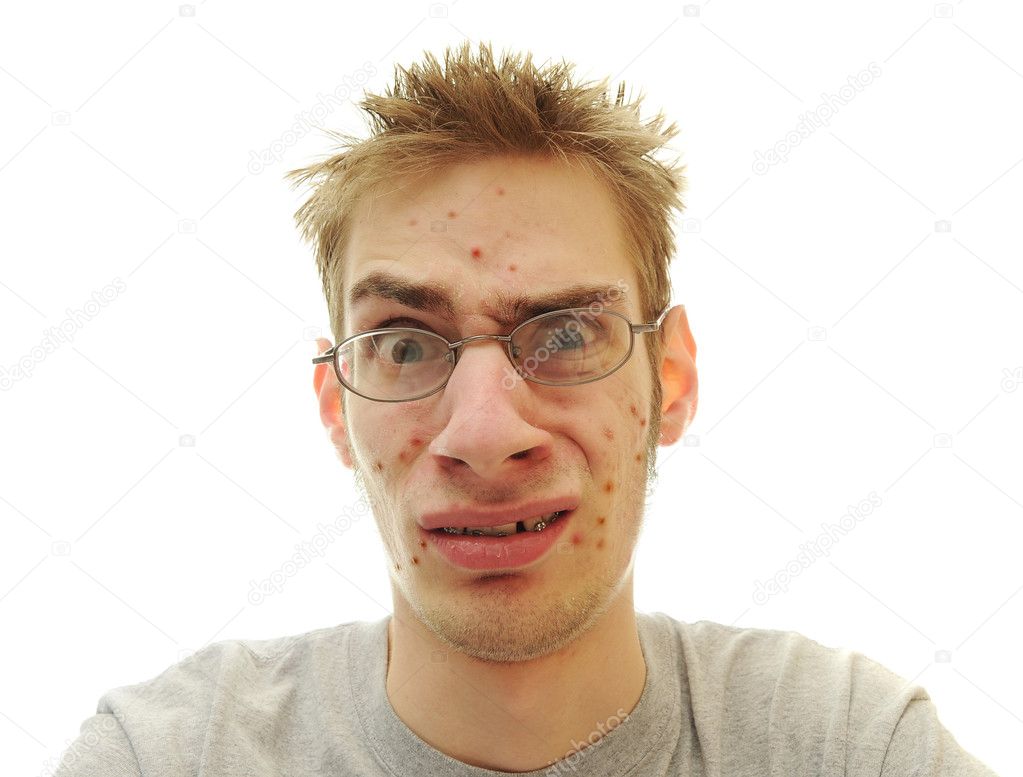 depositphotos_4629339-Teenager-Acne-Problem.jpg